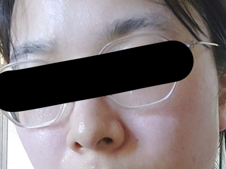 スッキリした肌？